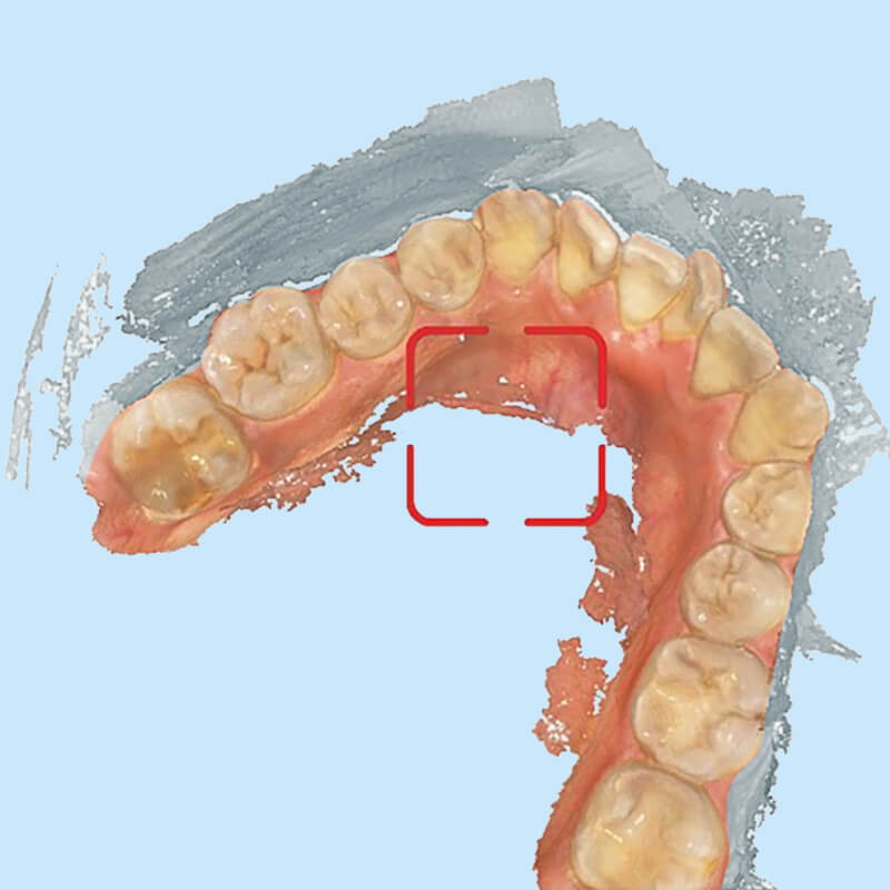 Image link