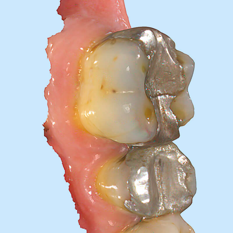 Image link