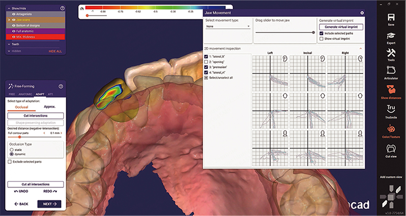 Diagnostika TMD Shining 3D MetiSmile-MR 