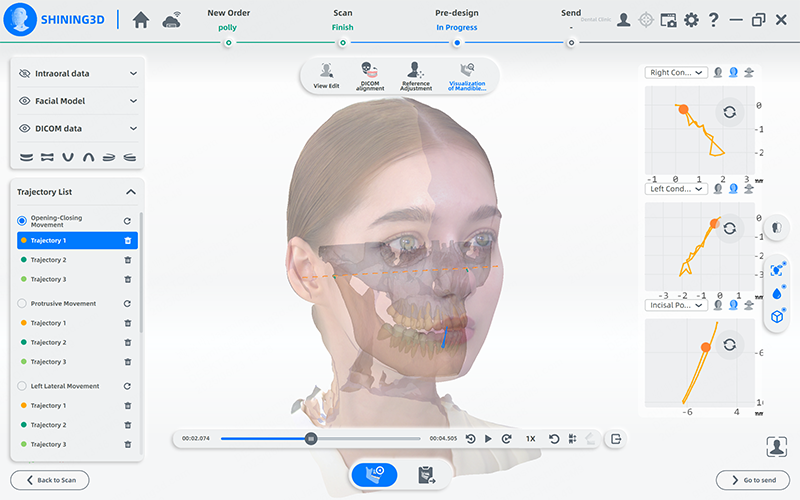 Obličejový skener SHINING 3D&nbsp;– MetiSmile MR